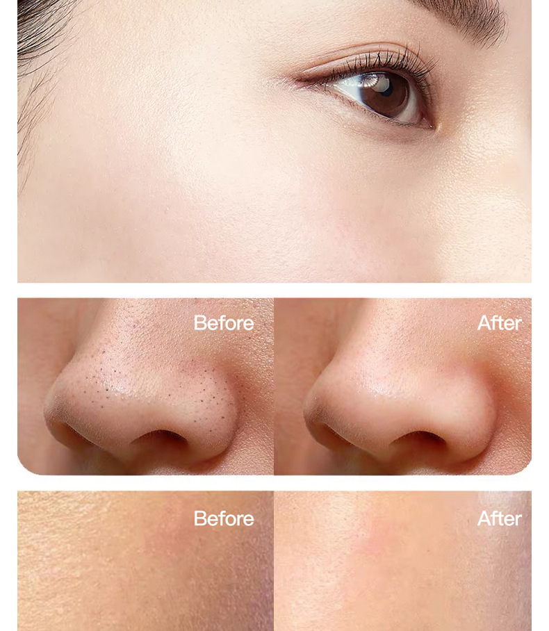 暨大紧致小v脸浅导冻干粉组合装美容院纳米微针导入面部精华液套