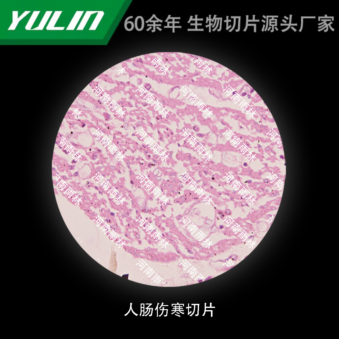 肠伤寒切片高校医学院校用组织病理石蜡玻片标本显微镜生物切片评价
