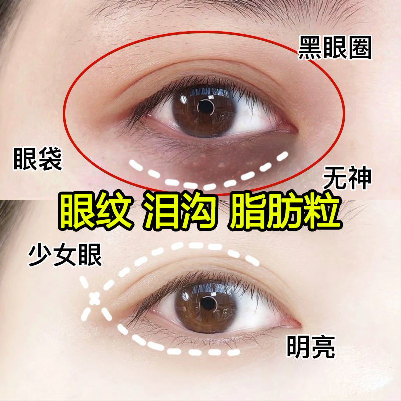 眼霜去皱紧致淡化细纹去眼袋黑眼圈鱼尾纹消除脂肪粒抗皱眼霜正品