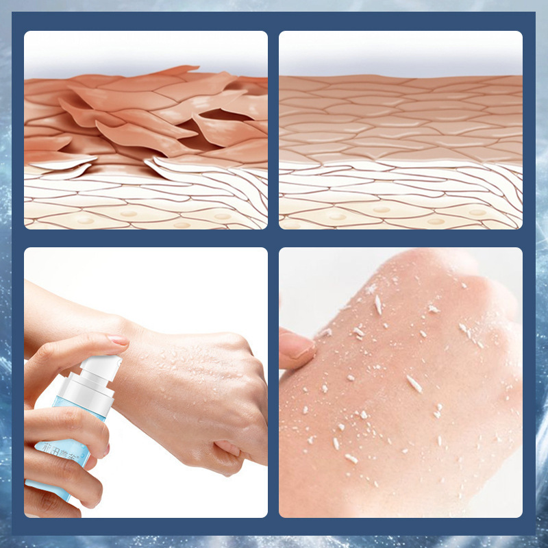 花田美芙去角质慕斯喷雾面部男女士学生脸部去死皮黑头全身磨砂膏