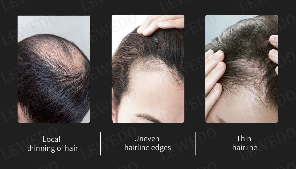 头发纤维粉一次性补发纤维25g 快速浓密纤维粉搭配梳子喷头定型水