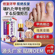 岩井昃弘灰指甲亮甲脱甲增厚发黄专用凤仙花抑菌液冰醋酸工厂直营