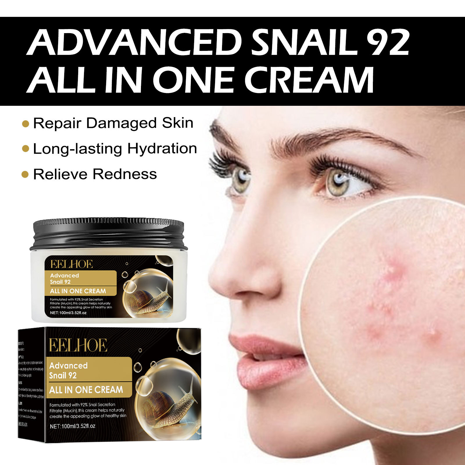 Eelhoe Snail 92 Recovery Cream Fade Acne Skin Acne Marks Hydrating Whitening Firming Skin Cream
