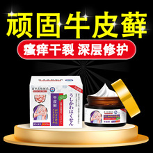 岩井昃弘牛皮廯癣止痒药膏正品杀菌顽固性外用皮肤专用膏工厂直营