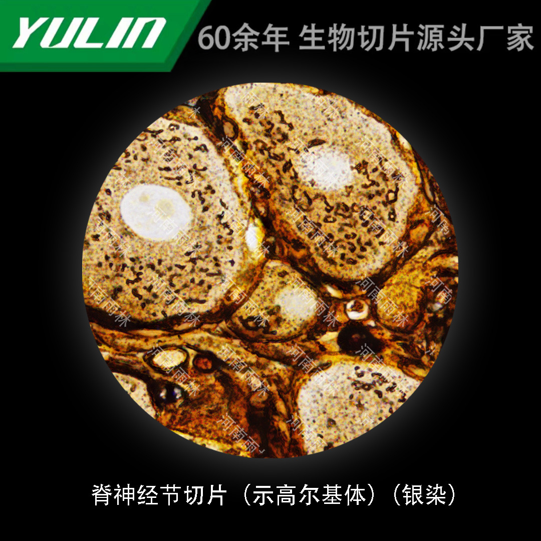 脊神经节切片(示高尔基体)(银染)高校医学院校用组织病理石蜡