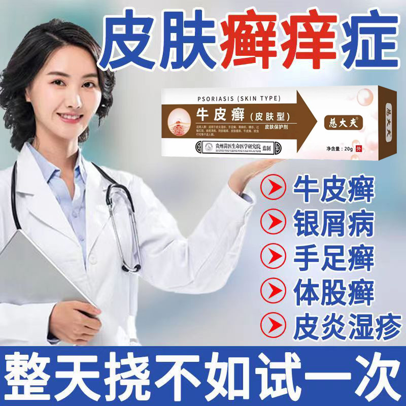 牛皮廯藓癣银屑病膏皮肤瘙痒湿疹根去止痒头股体手足癣专用药膏