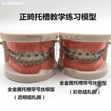 牙齿模型牙科正畸带托假牙模型 医患沟通教学模型 矫正练习托