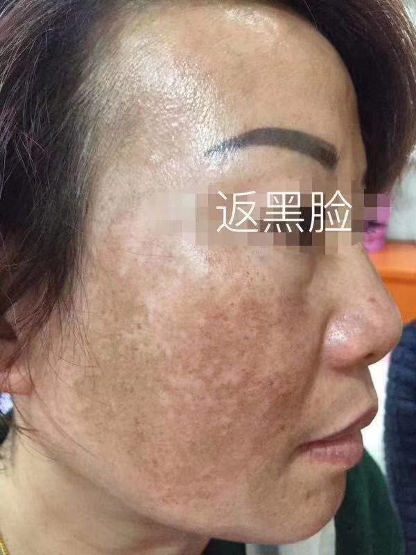 靓肤素靓颜晚霜熊果苷护理色素回流印滋养黄黑暗斑肌肤