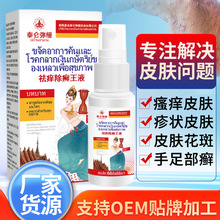 祛痒除癣王液皮毒清喷癣痒王喷剂止痒外用草本除癣皮肤瘙痒喷雾