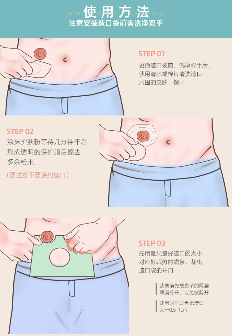 健之佳造口袋一件式开口型造口袋结肠术后造口护理人工造瘘袋