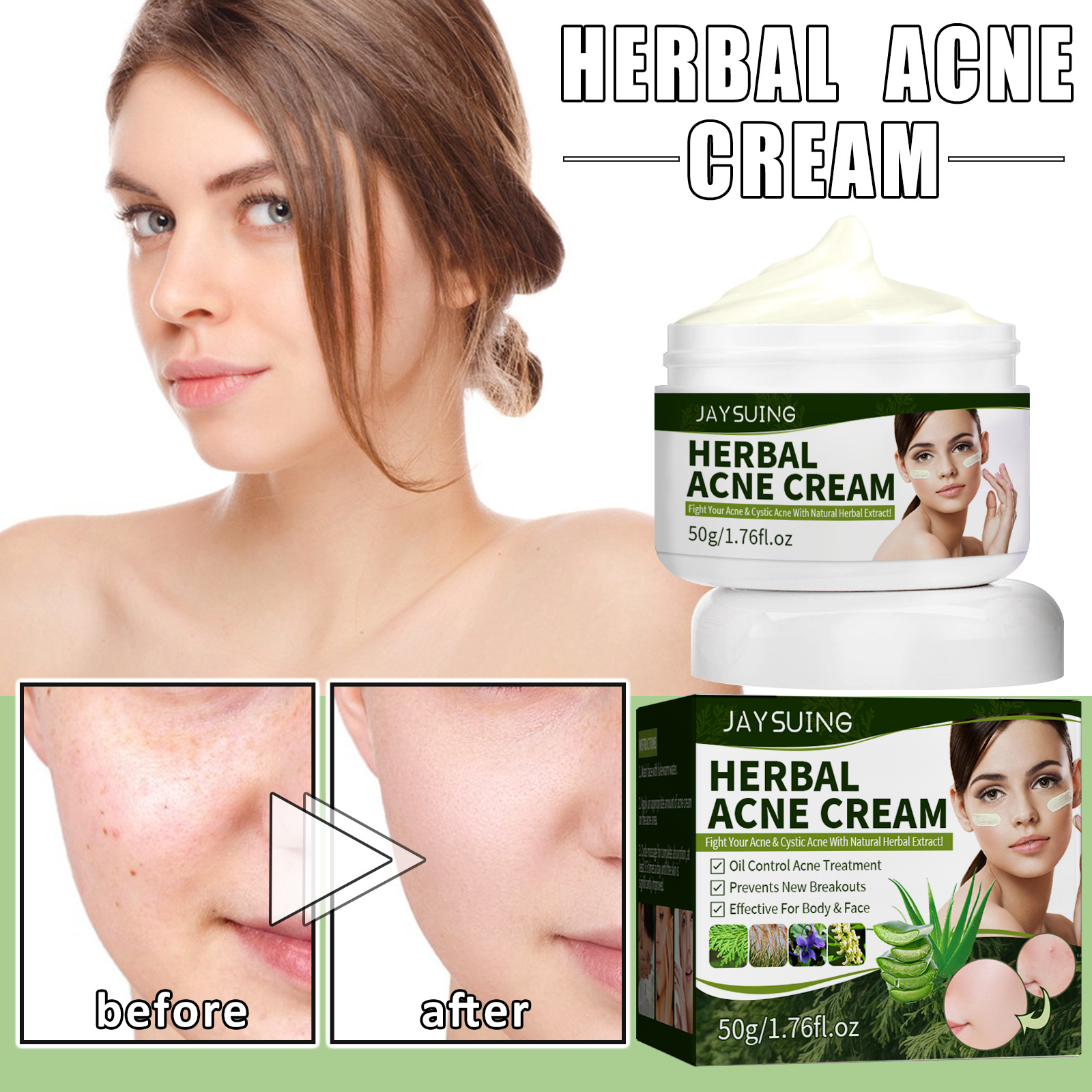 jaysuing 草本净痘霜 净痘印粉刺青春痘修护痘坑温和滋润清洁亮肤