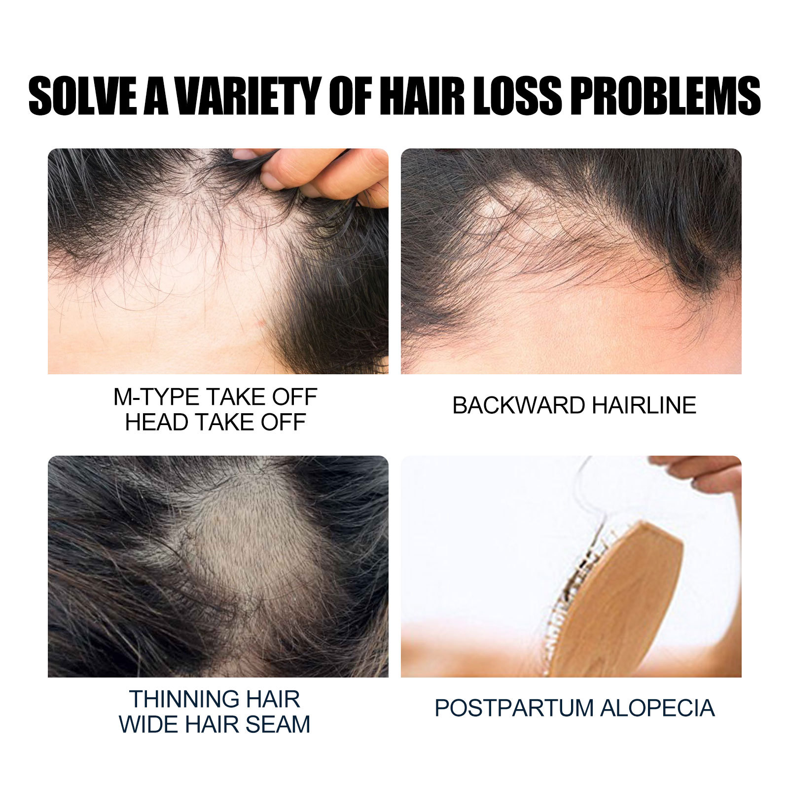 Eelhoe Dense Hair Essence Repair Damaged Hair Hair Root Thick Hair Anti-Fall Hair Fixing Essential Oil