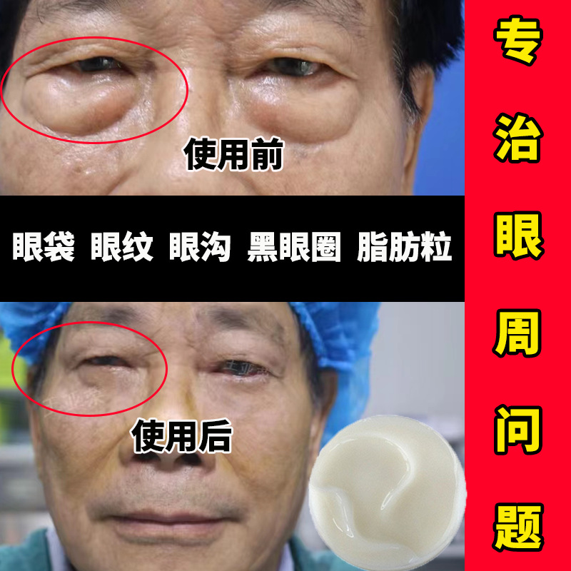 玻色因抗皱眼霜改善眼纹眼皮松弛去脂肪粒黑眼圈去皱紧致修护眼霜