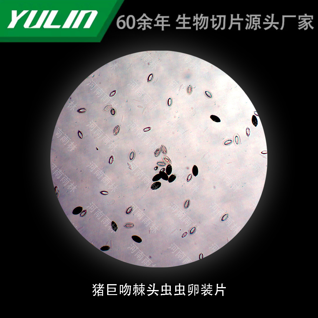 猪巨吻棘头虫虫卵装片高校医学院校用组织病理石蜡玻片标本显微镜