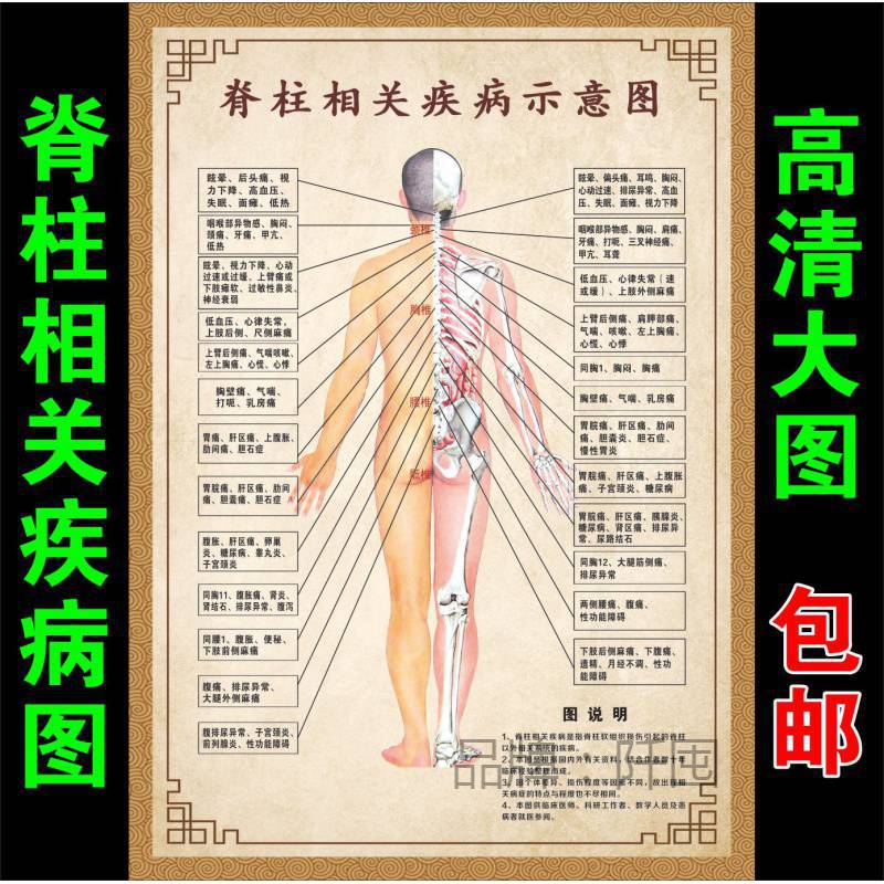 脊柱相关疾病人体经络穴位图大挂图院中医养生图片宣传画海报