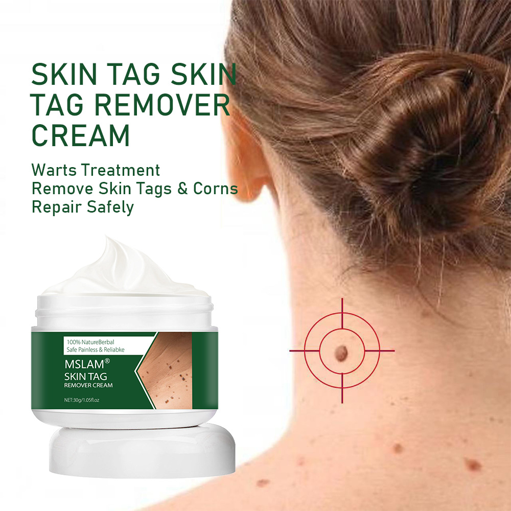 跨境速卖通祛疣膏平疣霜鸡眼点痣克疣膏肉粒软膏skin tag remover
