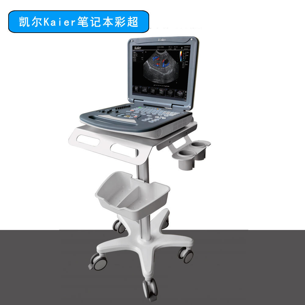 手提便携式彩超机厂家人医用b超机仪器笔记本设备四维多普勒超声