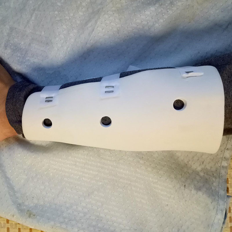 高分子医用胫腓骨固定支具 小腿外固定支具 下肢骨折pvc支具托具