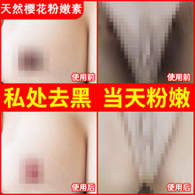 嫩红素私处粉嫩淡化黑色素变粉护理保养紧致凝胶少女性乳晕粉嫩术