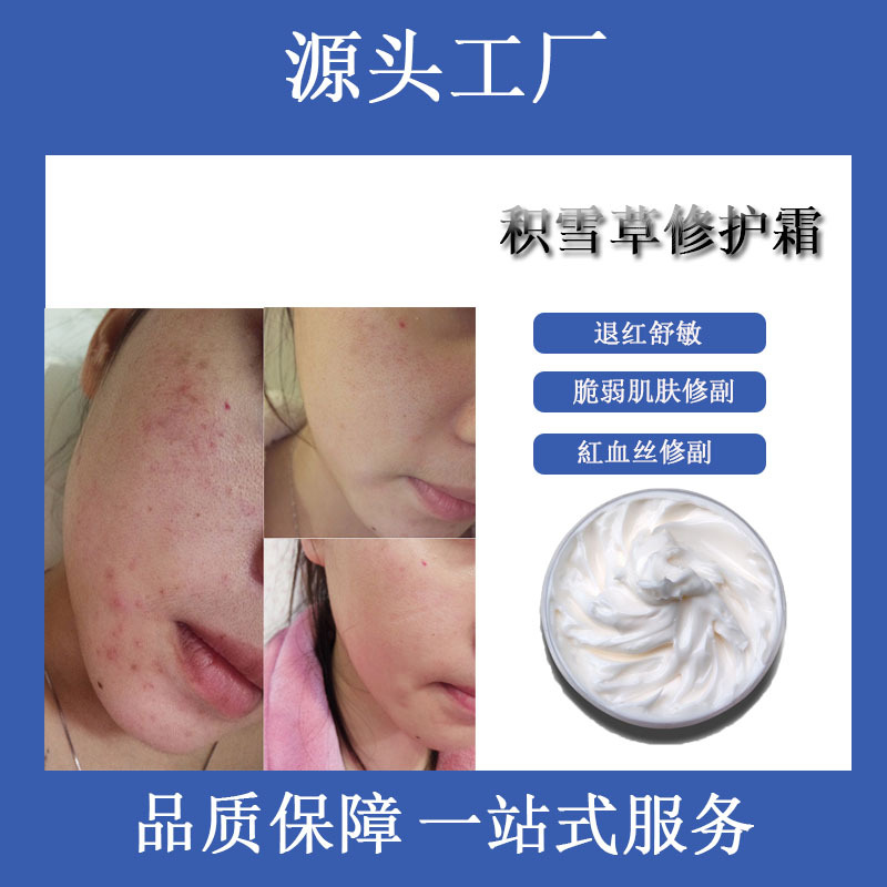 积雪草激素脸修护霜调理敏感受损肌舒缓痘痘肌泛红脸激素脸面霜