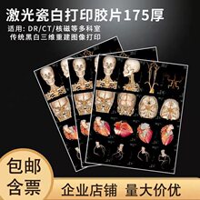 厂家供应175厚激光瓷白打印医用胶片A3规格DR/CT/X光放射科胶片