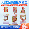 teaching simulation human body The large intestine Pathology Model stomach Rectum Hemorrhoids Pathological changes anatomy Intestine disease Colon Pathological changes teaching simulation human body The large intestine Pathology Model stomach Rectum Hemorrhoids Pathological changes anatomy Intestine disease Colon Pathological changes