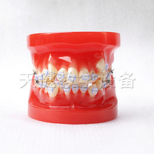 TJ-B4-03 全陶瓷28颗牙教学模型全陶瓷托槽口腔护理教学模型