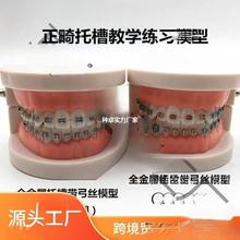 牙齿模型牙科正畸带托槽假牙模型 医患沟通教学模型 矫正练习托槽