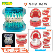 牙齿模型现货批发牙模型矫正金属陶瓷医患沟通教学牙套脱膜