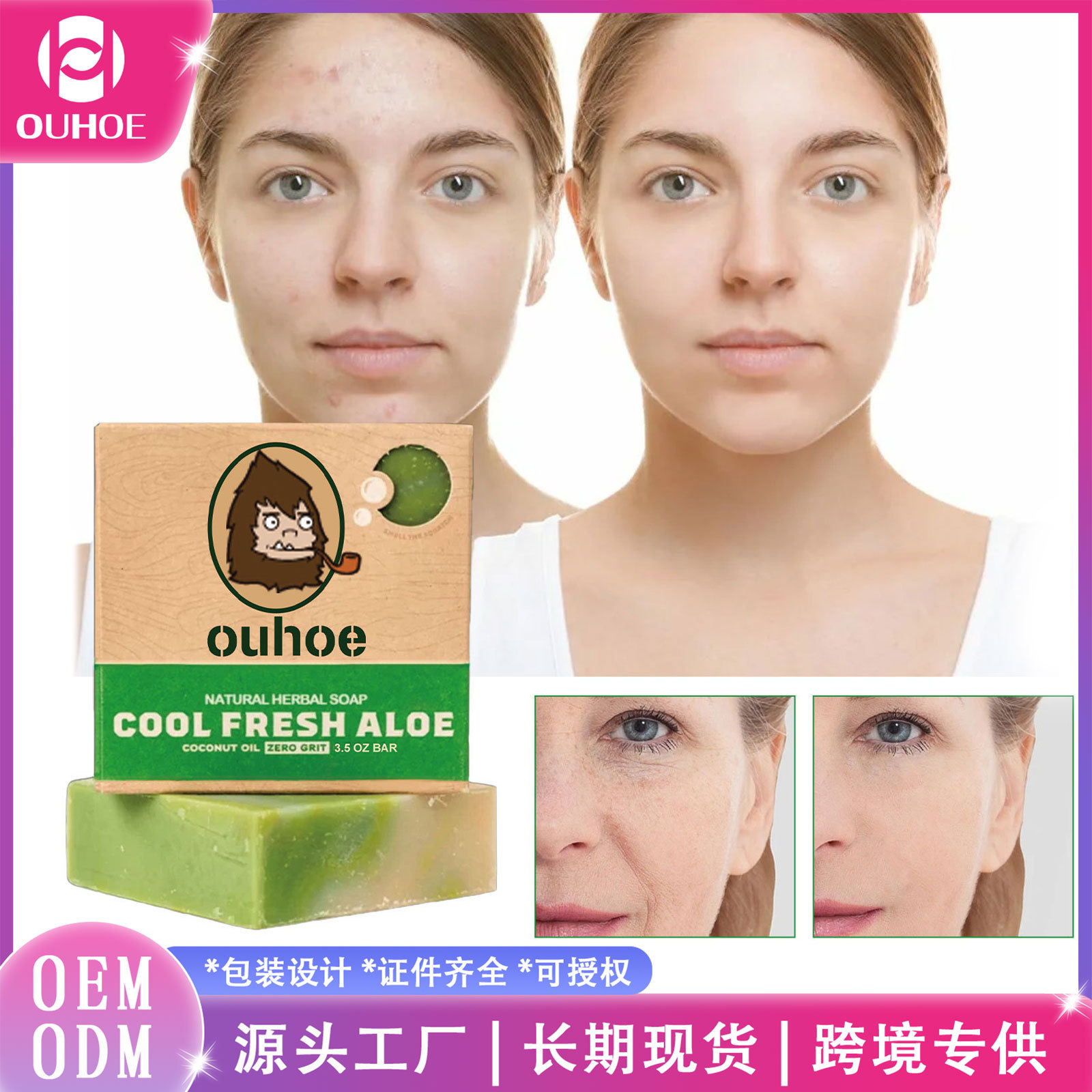 Ouhoe Herbal Cleansing Soap Smallpox Diluting Blackhead Acne Moisture Replenishment Repair Facial Skin Face Soap