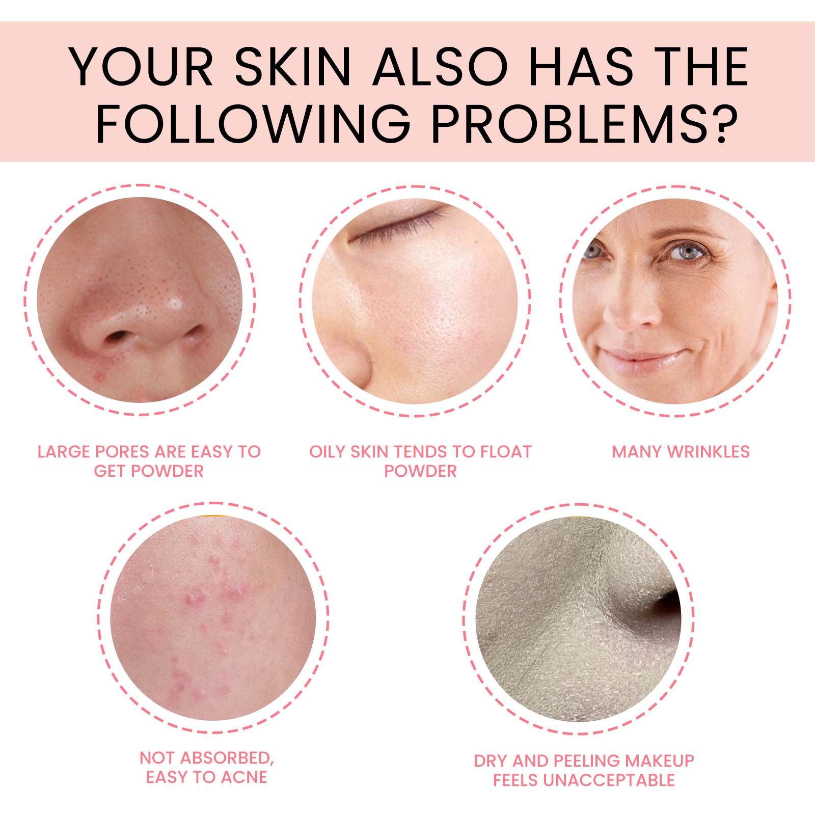 Eelhoe Foundation Essence Desalting Pimple Fine Lines Black Spot Skin Rejuvenation Even Skin Color Concealer