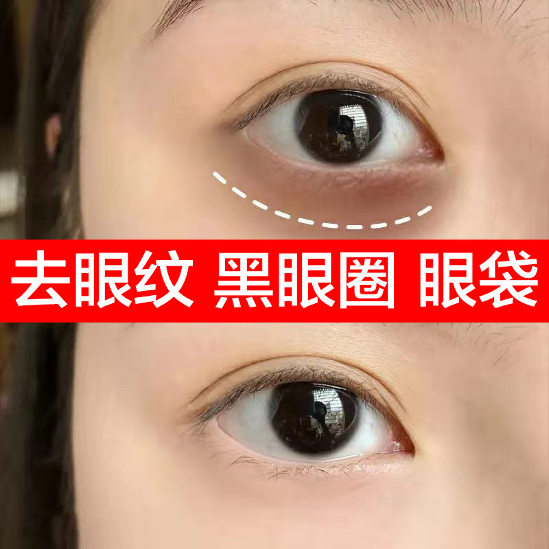 超声刀眼霜去抗皱紧致正品淡化纹致祛眼袋黑眼圈鱼尾纹脂肪粒眼霜