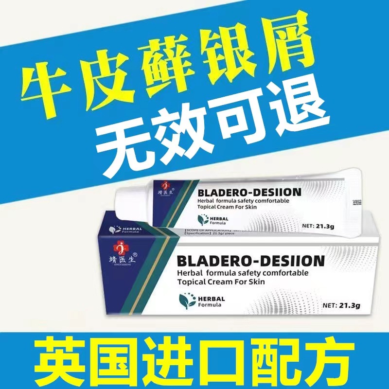 治疗顽固牛皮癣藓鲜银屑病湿疹外用皮肤病专用特效药膏英国进口药