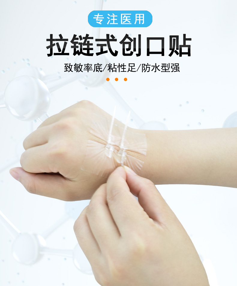 妥能弹性绑带绷带拉合皮肤缝合器拉链式创口贴减张器术后免缝