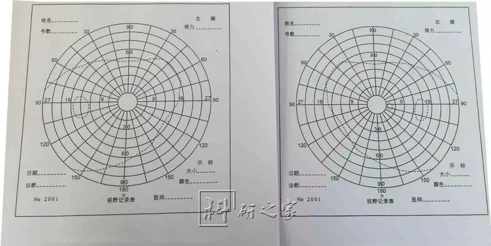 视野图纸 视野计图纸 左右眼各50张 视野计图纸
