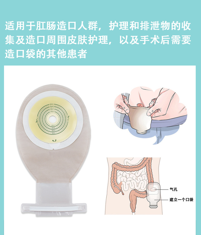 妥能肛肠一件式造口袋人工肛门袋大便造口护理用品直肠一次性造瘘
