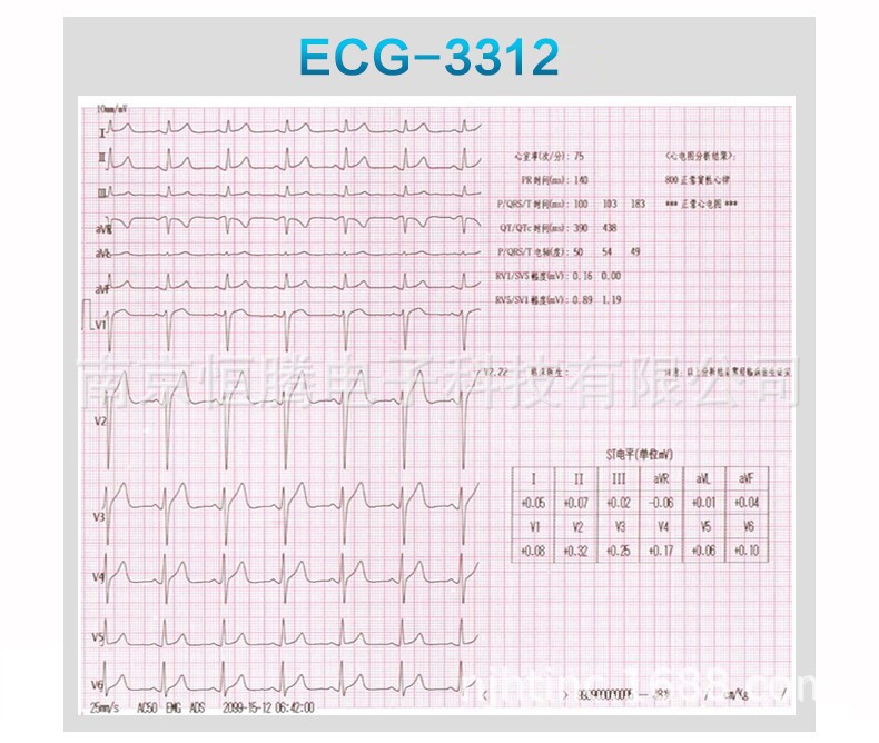 国产数字彩屏12导联脉冲识别存储打印十二道心电图机ecg-5512