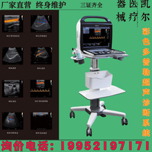 医用B超仪检测仪彩超掌超手持式B超机彩色多普勒检测仪厂家