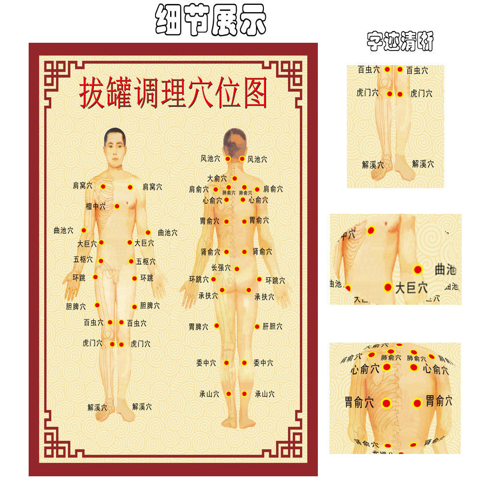 拔罐穴位图中医养生美容馆挂画拔罐理疗宣传海报