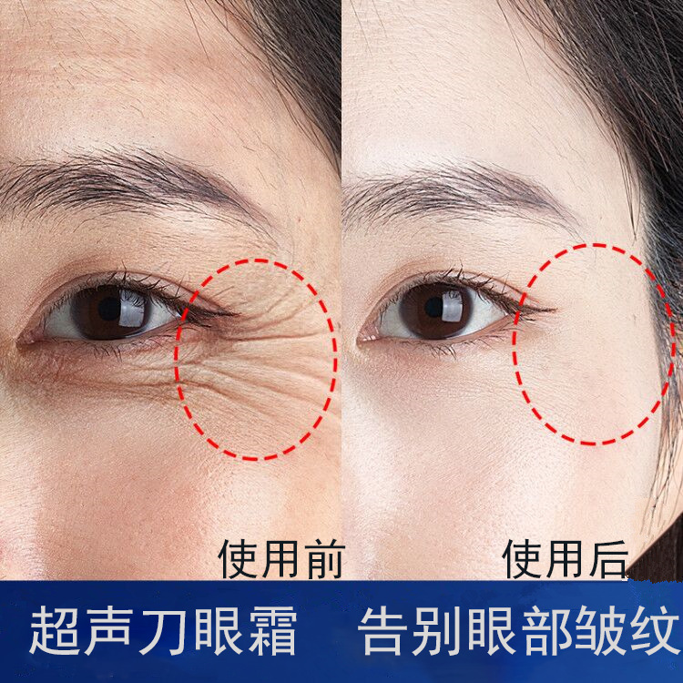 9成交179瓶微晶眼贴 法令纹抗皱800微晶眼膜贴改善黑眼圈眼袋淡化细纹