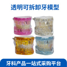 牙齿模型教学医患沟通齿科牙模模具透明儿童可拆卸种植体修复模型