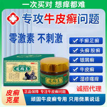 皮癣王乳膏50g皮癣外用软膏手足皮藓白癣皮肤瘙痒真菌止痒膏代发