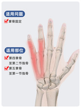第五掌骨托板固定器手掌小拇指支具手指指套手腕夹板固定辅助护具