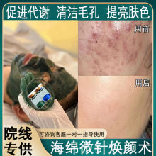 海绵微针去痘印淡色印 美容院线海藻矽针微晶 植物骨针改良色暗沉