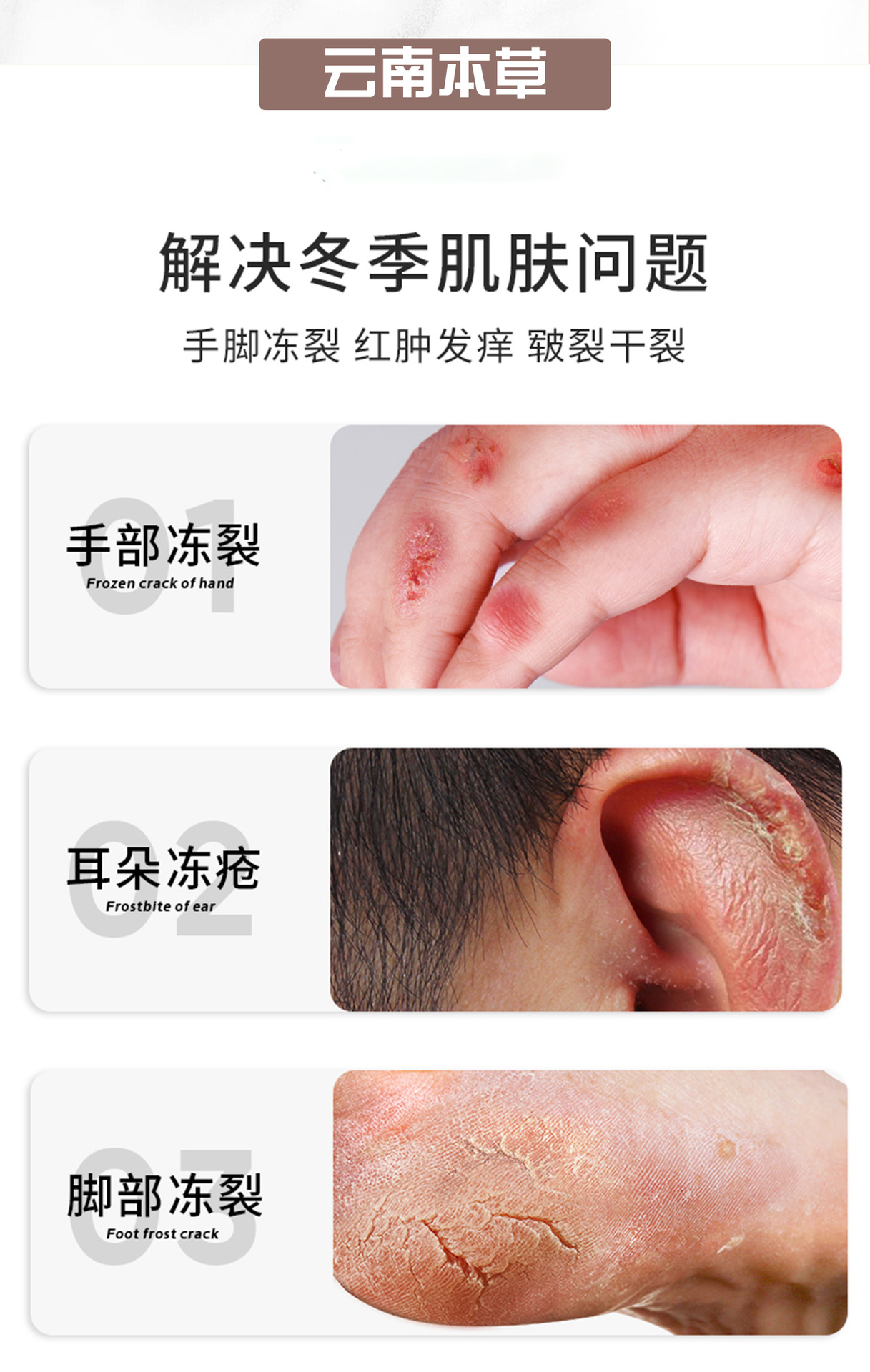 冻疮膏防裂修护膏脚后跟干裂手脚冻膏耳朵脸开裂凡士林马油护手霜