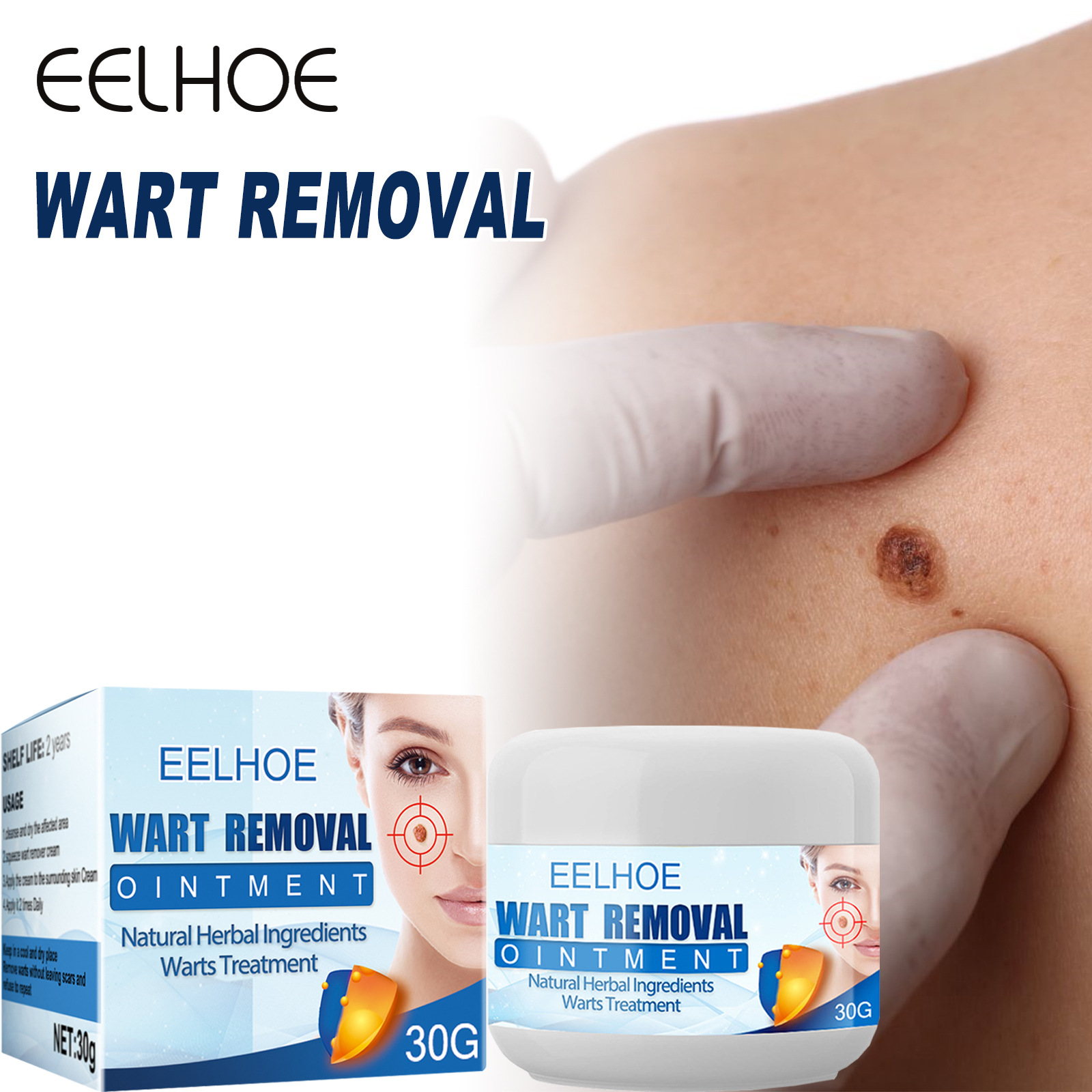 皮肤去尤膏克疣克尤膏手足脸部清洁护理肉粒脖子丝状平抑优瘊疣膏