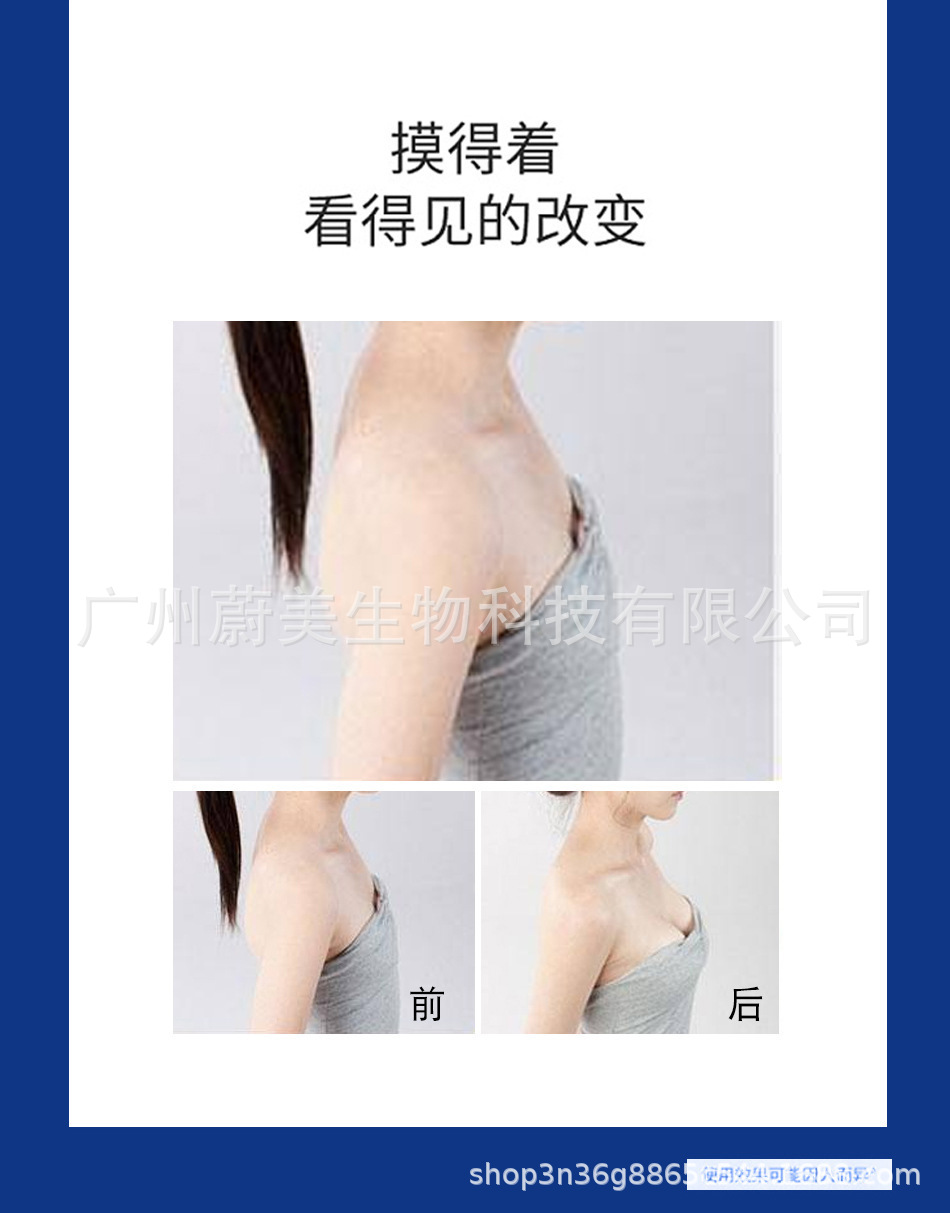 丰体玻尿酸丰胸丰臀丰体针原液凹陷填充厂家批发定制可oem