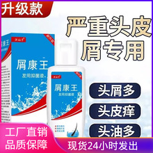 屑康王止痒去屑头皮油螨修护洗发膏清爽头油头藓发用洗发水抑菌液