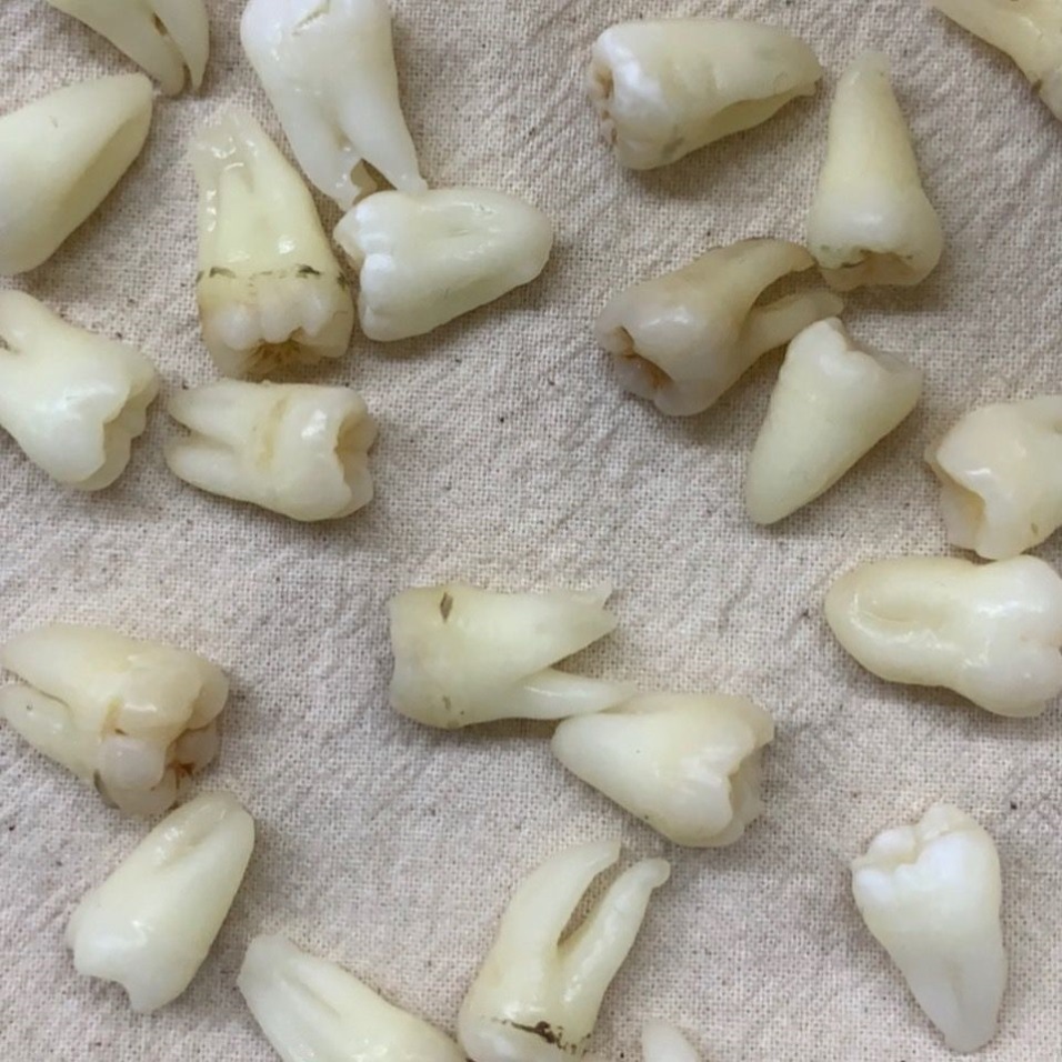 口腔技能考试专用真人离体牙真牙前磨牙开髓考试树脂备牙学生实验