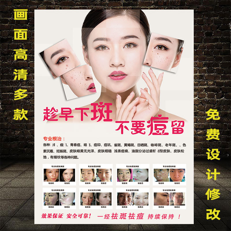 美容院祛斑海报图片宣传画美白脸专业祛斑祛痘广告效果对比图挂画